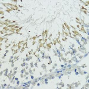 Immunohistochemistry analysis of paraffin-embedded rat testis using Anti-TRIP12 / ULF Antibody (A10849) at a dilution of 1:100 (40x lens). Perform microwave antigen retrieval with 10 mM PBS buffer pH 7.2 before commencing with IHC staining protocol.