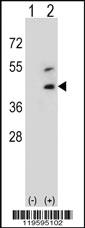 Anti-DCN Rabbit Polyclonal Antibody