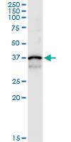 Anti-CTSS Polyclonal Antibody Pair