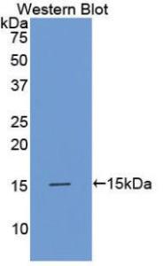 Anti-AMH Mouse Monoclonal Antibody [clone: 13j10]