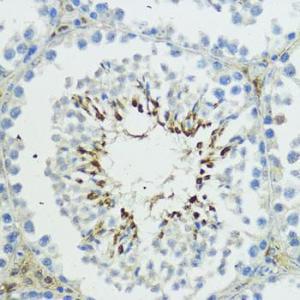 Immunohistochemistry analysis of paraffin-embedded mouse testis using Anti-TRIP12 / ULF Antibody (A10849) at a dilution of 1:100 (40x lens). Perform microwave antigen retrieval with 10 mM PBS buffer pH 7.2 before commencing with IHC staining protocol.