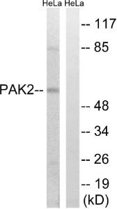 Western blot analysis of lysates from HeLa cells, treated with TSA 400 nM 24 h using Anti-PAK2 Antibody. The right hand lane represents a negative control, where the Antibody is blocked by the immunising peptide