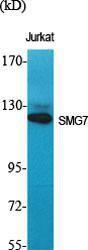 Western blot analysis of various cells using Anti-SMG7 Antibody