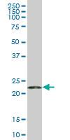 Anti-RPS5 Mouse Monoclonal Antibody [clone: 3G3]