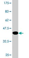 Anti-CALML3 Mouse Monoclonal Antibody [clone: 2A11]