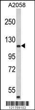 Anti-HA-1 Rabbit Polyclonal Antibody (FITC (Fluorescein))