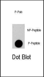 Anti-EIF4E Rabbit Polyclonal Antibody (PE (Phycoerythrin))