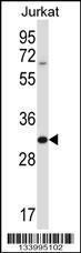 Anti-HRASLS5 Rabbit Polyclonal Antibody (APC (Allophycocyanin))