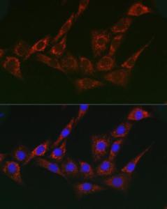 Immunofluorescence analysis of NIH/3T3 cells using Anti-gamma Adaptin Antibody (A307586) at a dilution of 1:200 (40x lens). DAPI was used to stain the cell nuclei (blue)