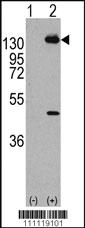 Anti-PDGFRA Rabbit Polyclonal Antibody