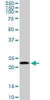 Anti-RPS5 Mouse Monoclonal Antibody [clone: 3G3]