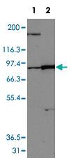 Anti-TYRO3 Rabbit Polyclonal Antibody