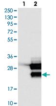 Anti-TCF21 Rabbit Polyclonal Antibody