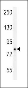 Anti-OCA2 Rabbit Polyclonal Antibody (AP (Alkaline Phosphatase))