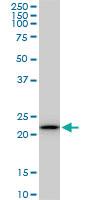 Anti-RPS5 Mouse Monoclonal Antibody [clone: 3G3]