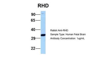 Anti-RHD Rabbit Polyclonal Antibody