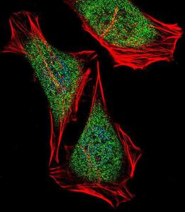 Anti-ECSIT Rabbit Polyclonal Antibody (AP (Alkaline Phosphatase))