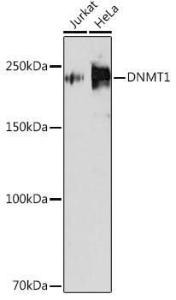 Western blot analysis of extracts of various cell lines, using Anti-Dnmt1 Antibody [ARC51348] (A307587) at 1:1,000 dilution The secondary antibody was Goat Anti-Rabbit IgG H&L Antibody (HRP) at 1:10,000 dilution Lysates/proteins were present at 25 µg per lane