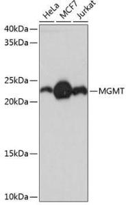 Western blot analysis of extracts of various cell lines, using Anti-MGMT Antibody [ARC0529] (A305868) at 1:1000 dilution