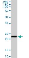 Anti-RPS5 Mouse Monoclonal Antibody [clone: 3G3]