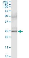 Anti-CEACAM21 Rabbit Polyclonal Antibody