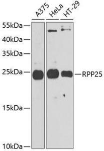 Western blot analysis of extracts of various cell lines, using Anti-RPP25 Antibody (A10851) at 1:1000 dilution