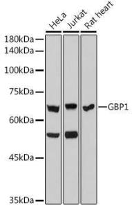 Western blot analysis of extracts of various cell lines, using Anti-GBP1 Antibody [ARC2521] (A308580) at 1:1,000 dilution The secondary antibody was Goat Anti-Rabbit IgG H&L Antibody (HRP) at 1:10,000 dilution Lysates/proteins were present at 25 µg per lane