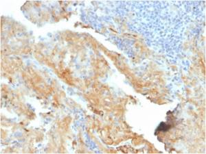 Immunohistochemical analysis of formalin-fixed, paraffin-embedded human lung using Anti-Fibronectin Antibody [FN1/2950]