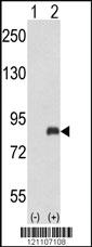 Anti-ADRBK2 Rabbit Polyclonal Antibody