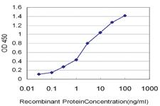 Anti-CRYBB1 Mouse Monoclonal Antibody [clone: 2B2]