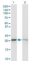 Anti-RPS5 Mouse Monoclonal Antibody [clone: 3G3]