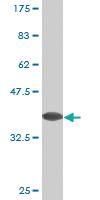 Anti-FABP1 Mouse Monoclonal Antibody [clone: 5E7]