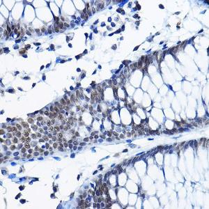 Immunohistochemistry analysis of paraffin-embedded human colon tissue using Anti-RPP25 Antibody (A10851) at a dilution of 1:100 (40x lens). Perform high pressure antigen retrieval with 10 mM citrate buffer pH 6.0 before commencing with IHC staining protocol