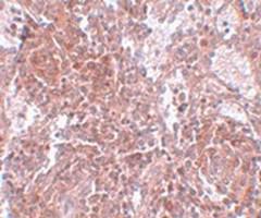 Anti-TSPAN9 Rabbit Polyclonal Antibody