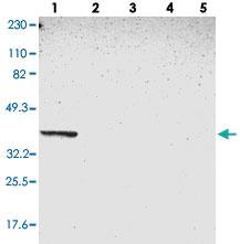 Anti-FAM199X Rabbit Polyclonal Antibody