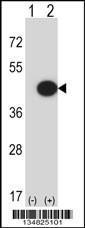 Anti-MAPK13 Rabbit Polyclonal Antibody (FITC (Fluorescein Isothiocyanate))