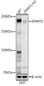 Western blot analysis of extracts from wild type (WT) and DNMT1 knockdown (KD) 293T cells, using Anti-Dnmt1 Antibody [ARC51348] (A307587) at 1:1,000 dilution The secondary antibody was Goat Anti-Rabbit IgG H&L Antibody (HRP) at 1:10,000 dilution Lysates/proteins were present at 25 µg per lane