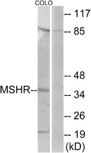 Anti-MSHR antibody