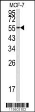 Anti-EEF1A1 Rabbit Polyclonal Antibody