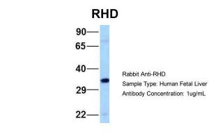 Anti-RHD Rabbit Polyclonal Antibody