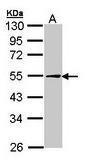 Anti-PLIN2 Rabbit Polyclonal Antibody