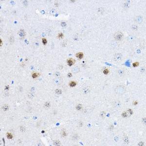 Immunohistochemistry analysis of paraffin-embedded mouse brain using Anti-RPP25 Antibody (A10851) at a dilution of 1:100 (40x lens). Perform high pressure antigen retrieval with 10 mM citrate buffer pH 6.0 before commencing with IHC staining protocol