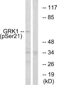 Anti-GRK1 Rabbit Polyclonal Antibody