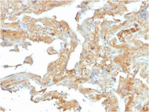 Immunohistochemical analysis of formalin-fixed, paraffin-embedded human lung using Anti-Fibronectin Antibody [FN1/2950]