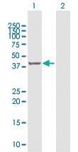 Anti-MVK Rabbit Polyclonal Antibody