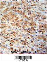 Anti-PRDX1 Rabbit Polyclonal Antibody