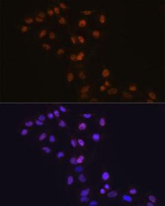 Immunofluorescence analysis of C6 cells using Anti-Dnmt1 Antibody [ARC51348] (A307587) DAPI was used to stain the cell nuclei (blue)