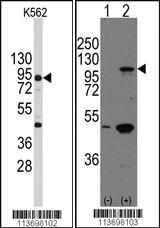 Anti-CDH3 Rabbit Polyclonal Antibody