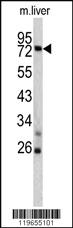 Anti-TNFAIP2 Rabbit Polyclonal Antibody