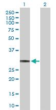 Anti-HLA-DQA1 Rabbit Polyclonal Antibody